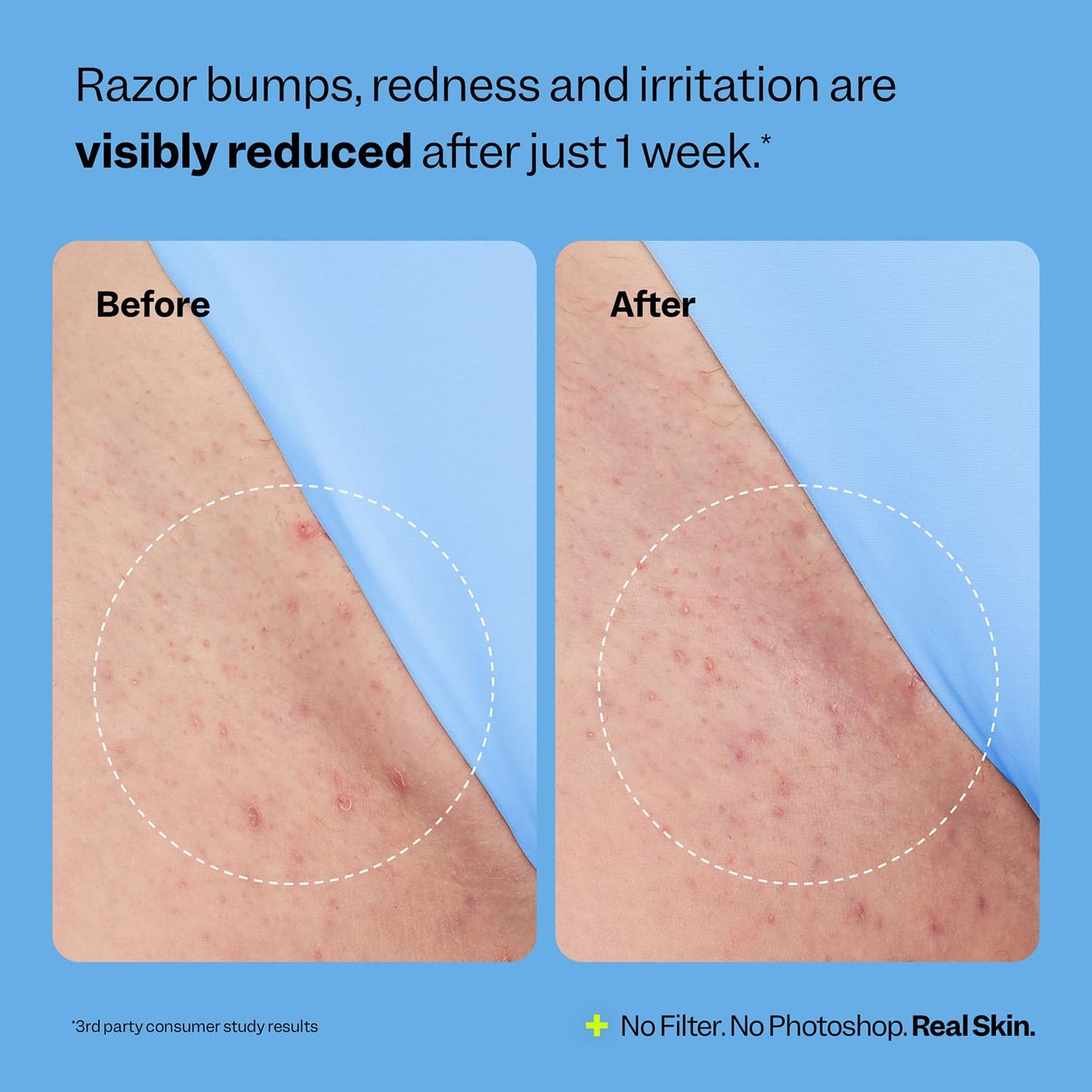 Peach Slices Smoothing Solution Ingrown Hair Treatment